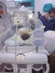 Neonato con gastrosquisis es evacuado de emergencia al hospital regional de Chiclayo